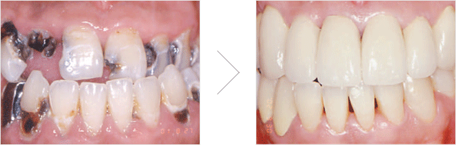 ���μ� (Esthetic line)