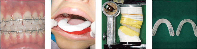 �ǰ� ������ġ ���� (���� ��, ���� �� ���)