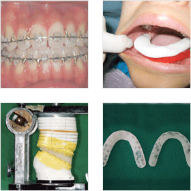 ¾Ç°£ °íÁ¤ÀåÄ¡ Á¦ÀÛ (¼ö¼ú Àü, ¼ö¼ú ÈÄ Àåºñ)