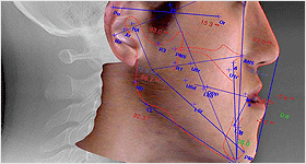 °¡»ó¼ö¼ú & °èȹ¼ö¸³