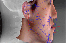 °¡»ó¼ö¼ú & °èȹ¼ö¸³